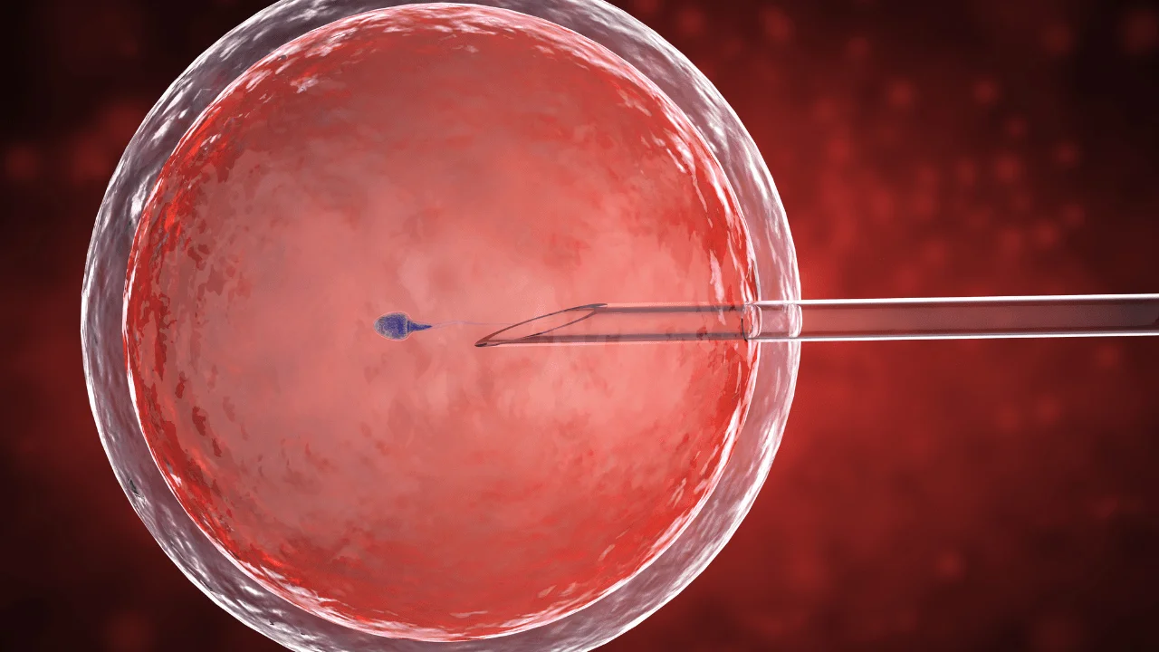 In Vitro Fertilization (IVF)